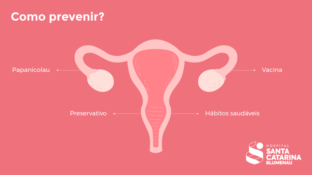 Ilustração. Fundo rosa com desenho de um útero. Então, na imagem, há alguns textos de como prevenir o câncer de colo de útero, nos quais se lê: 
"Papanicolau", "Vacina", "Preservativo" e "Hábitos saudáveis".